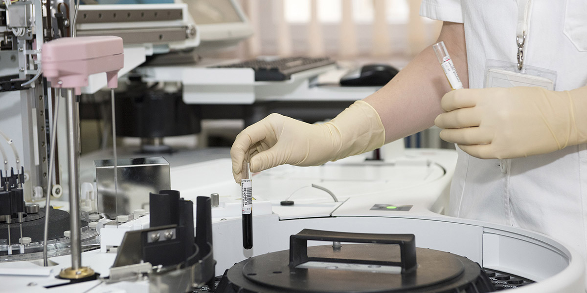 Defining Your Hospital Lab Program’s Value in the Face of PAMA Cuts