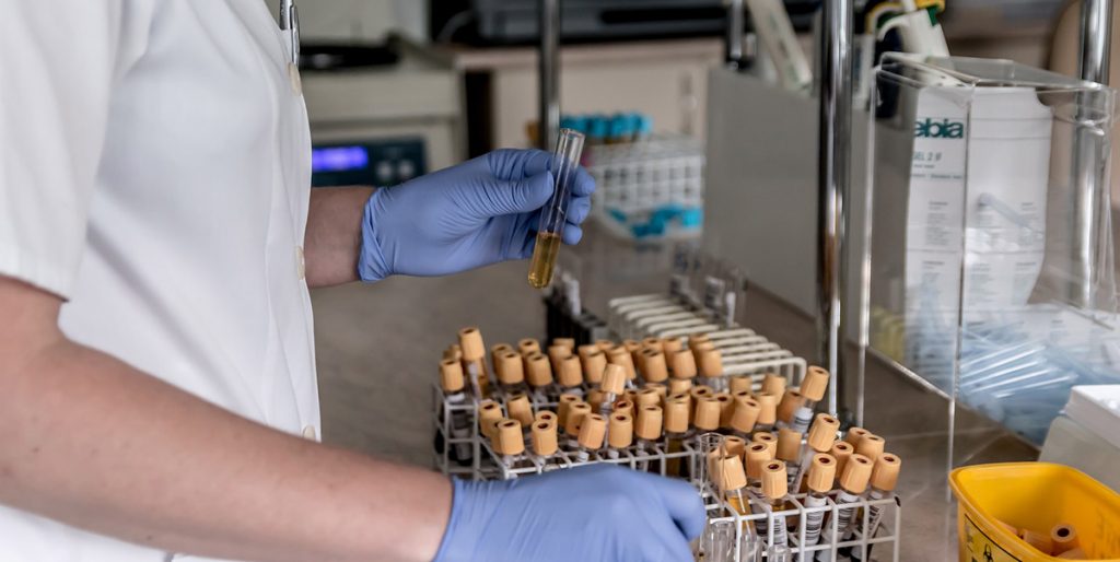 Lab Tech handling test tubes